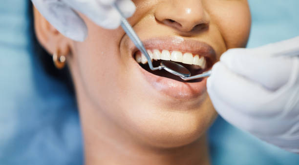 Best Dentist for Tooth Abscess  in Savannah, MO